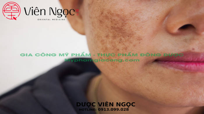 Gia công mỹ phẩm trọn gói